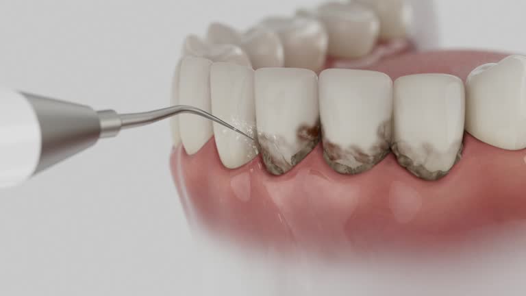 Trusted Teeth Whitening service in Powell, WY - Dentist Open Now